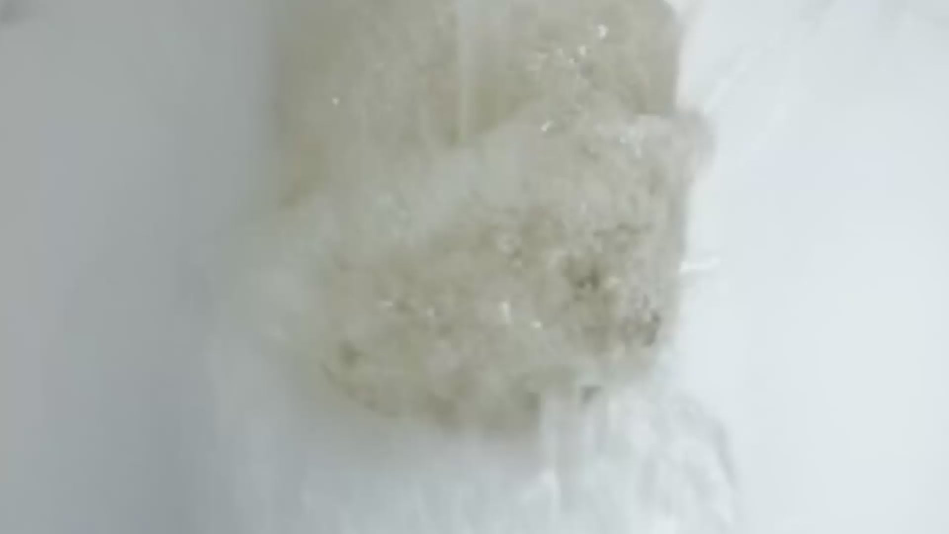 加载视频：肾脏毒素堆积？警惕肾脏受损的10大信号！